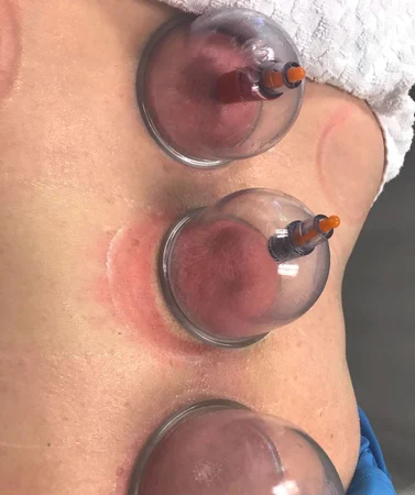 Jhe Massoterapeuta formada e experiente ! Massagem