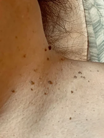Heloana oliveira/terapias manuais, conheça ! Massagem nuru