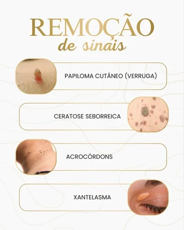 Heloana oliveira/terapias manuais, conheça ! Massagem nuru